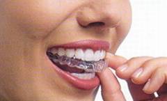 Aparate dentare: Invisalign