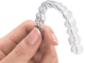 Aparate dentare: Invisalign
