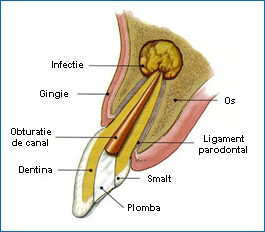 Rezectie Aplicata