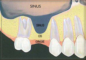 sinus-ce-este