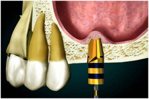 sinus-intern-1