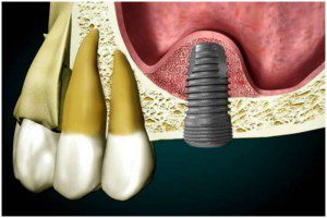 sinus-intern-2